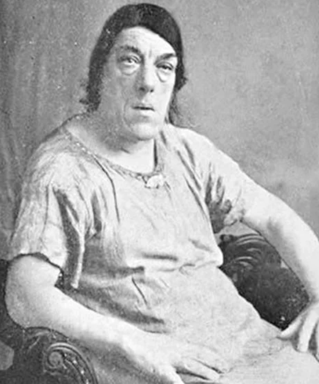 她被称为世上最丑的女人,却被富豪娶走,死后被制成标本供人欣赏