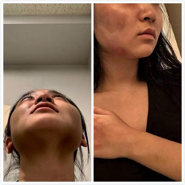 危险！福建女子在柬埔寨被老乡暴力强奸数次，报警后竟遭到威胁