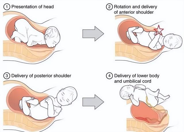 与动物相比，为什么人类女性生孩子如此困难？