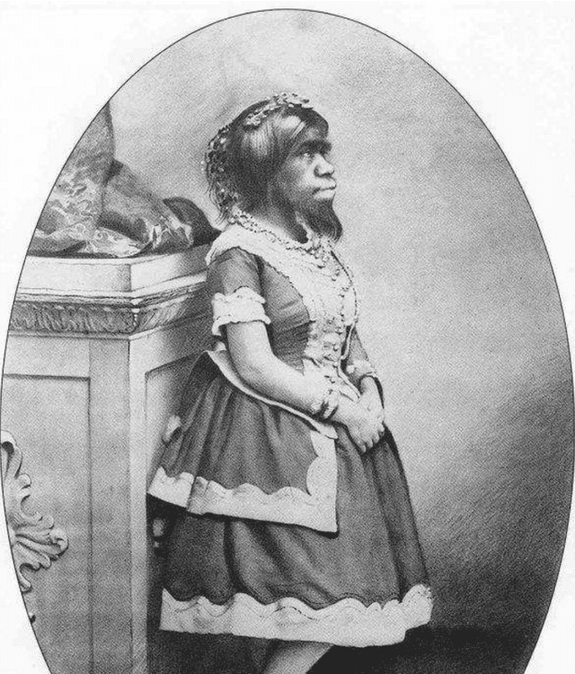 她是全世界最丑的女人，生前红极一时，死后被做成标本展览