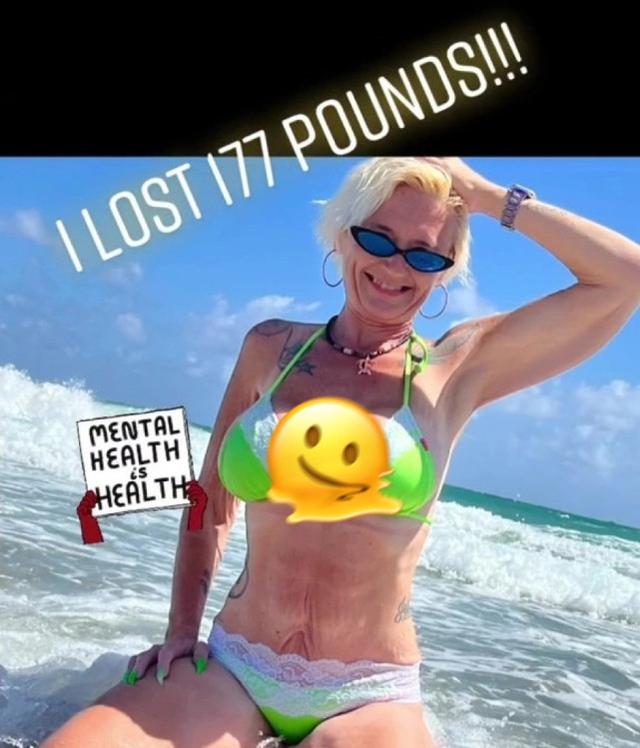 外国40岁女生减重180斤，分享比基尼照，却被嘲太老、腿像融化了