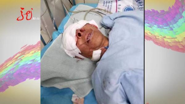 男子不幸与黑熊狭路相逢,血肉模糊!他倒地装死