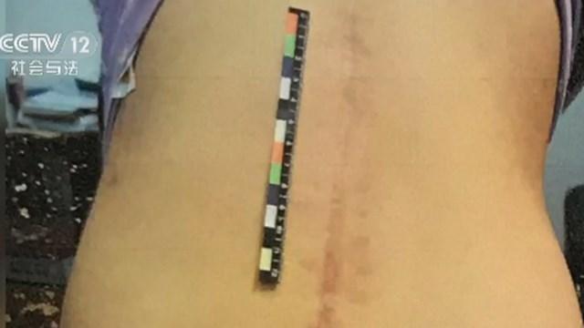 17岁女孩从高空一跃而下 曾遭超两个小时校园暴力