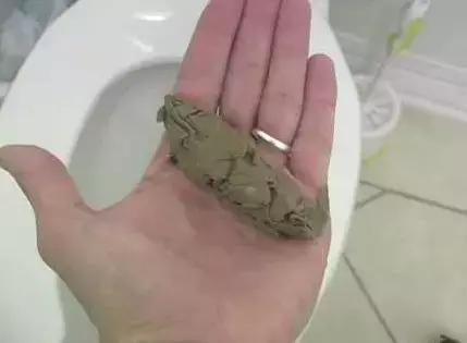 比尔·盖茨为非洲盖史上最牛厕所！全程不用一滴水，排出来还能喝