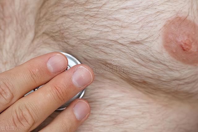 男性的乳头是用来干嘛的？医生：除了区分正反面，还有这4个用处