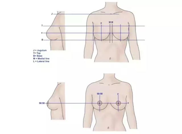 美沃斯早参0817｜最美乳头乳晕位置比例;O2O平台与百度营销对比