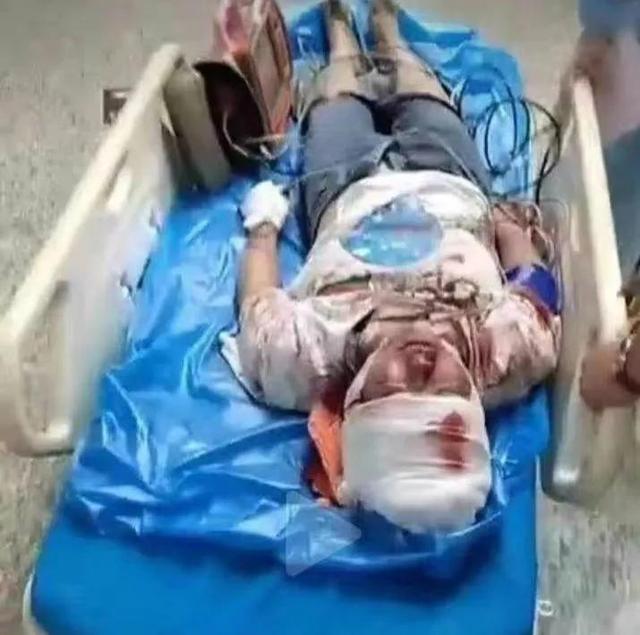 唐山事件：明明有两个女孩受伤住院，为何只有一个人的照片？