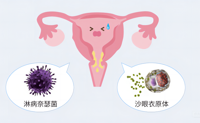 女性的内裤有分泌物，是怎么回事？别害羞，这些异常尽早了解