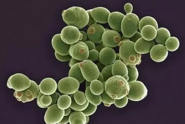 女性的内裤有分泌物，是怎么回事？别害羞，这些异常尽早了解