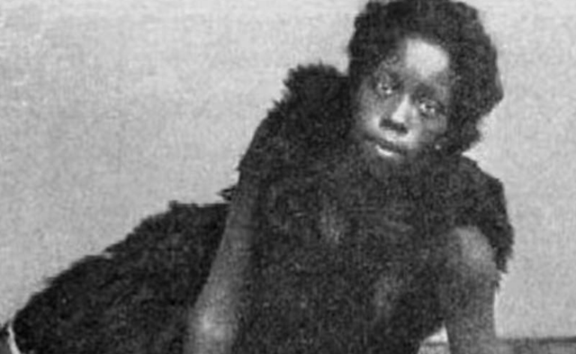 她被称为世上最丑的女人,却被富豪娶走,死后被制成标本供人欣赏