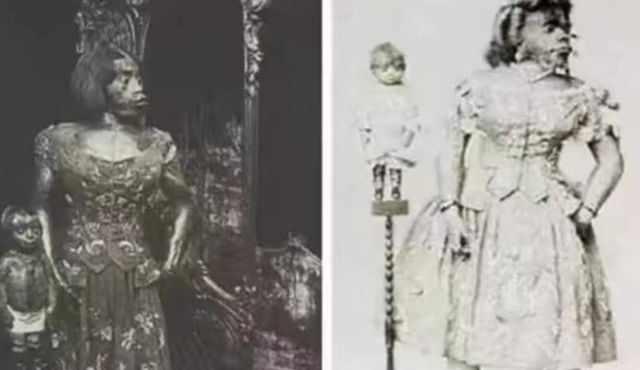 她被称为世上最丑的女人,却被富豪娶走,死后被制成标本供人欣赏