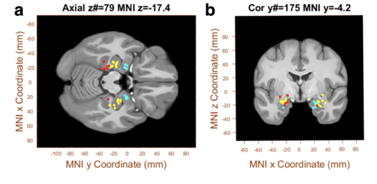 我刚才干了什么？研究发现：人体大脑两组神秘的神经元