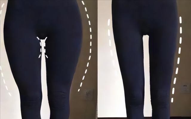 “少女胯”与“妇女胯”有何区别？看当红女明星的站姿，一目了然