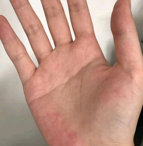 手有“凤尾纹”的女人，天生富贵命，必嫁贵夫，注定一生衣食无忧