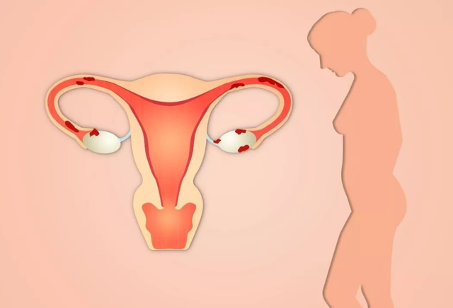 女性的内裤有分泌物，是怎么回事？别害羞，这些异常尽早了解