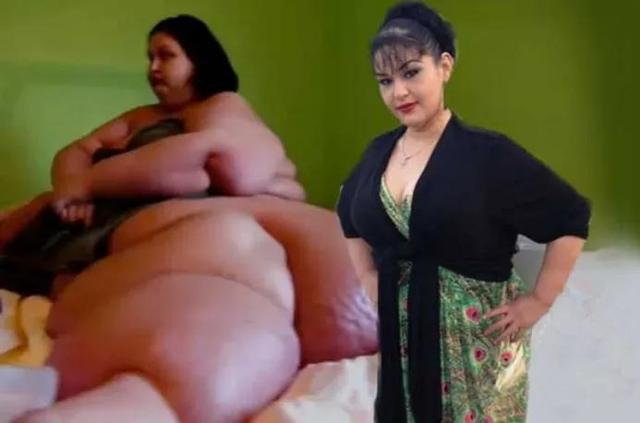 梅拉：世界第一胖，被妹妹陷害遭丈夫抛弃，后狂减800斤实现蜕变