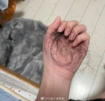 热的冷知识｜女孩突然倒地抽搐！医生：这种病一半是年轻人