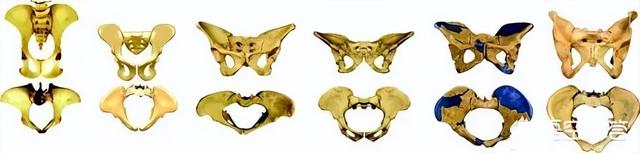 与动物相比，为什么人类女性生孩子如此困难？