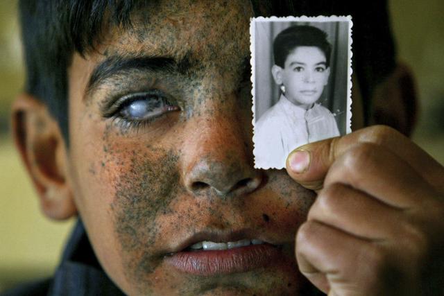 找茬游戏：今天轮到棉花了？