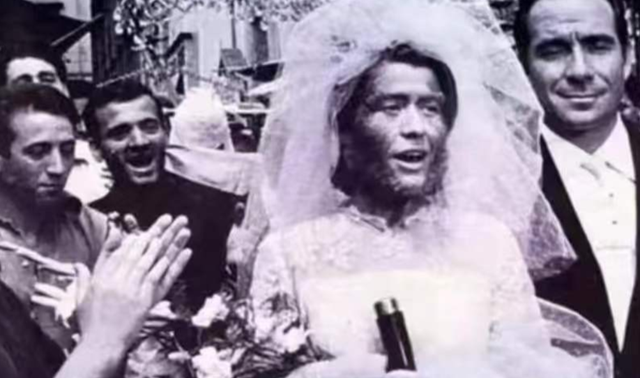 她被称为世上最丑的女人,却被富豪娶走,死后被制成标本供人欣赏