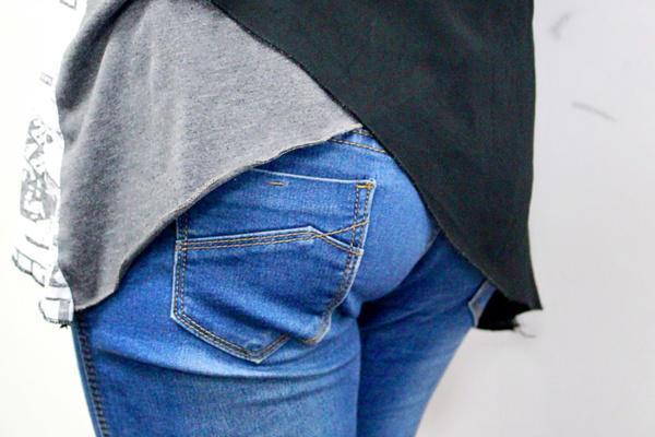 肛门处的小肉疙瘩是什么？可能不只是痔疮这么简单，提前了解