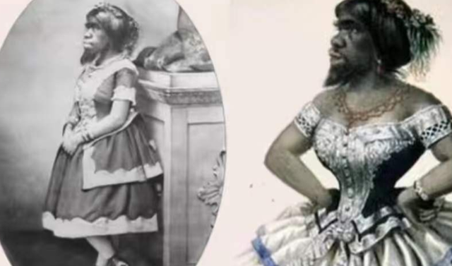 她被称为世上最丑的女人,却被富豪娶走,死后被制成标本供人欣赏