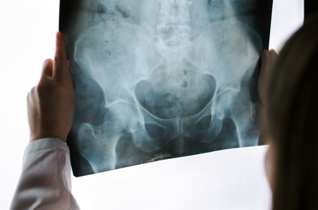 女性朋友注意！下身有这4种变化，警惕阴道肥大，4大危害难以启齿