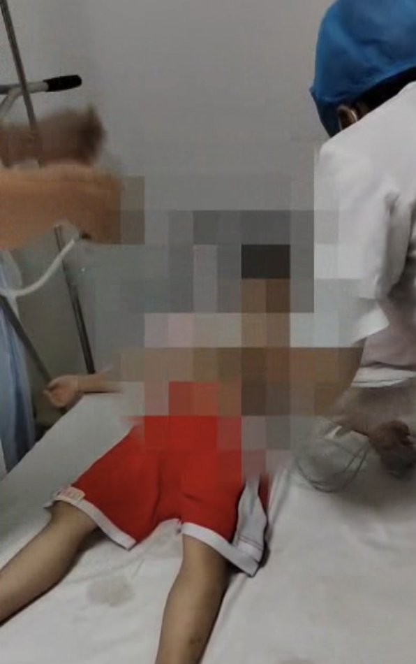 4岁女童脖子被夹，一度陷入昏迷！家长们千万注意