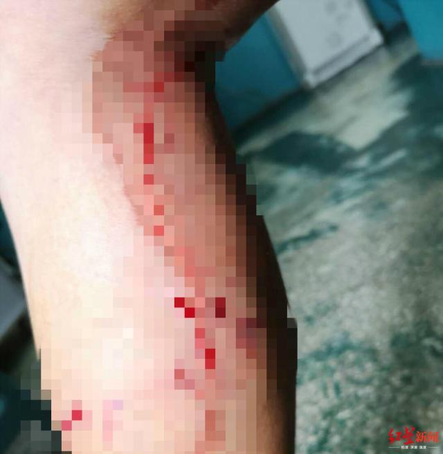 宜宾2条恶犬连咬5人被打死：疑附近居民所养警方已介入