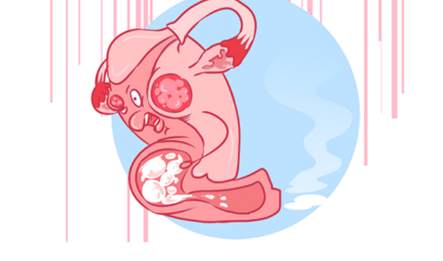 女性的内裤有分泌物，是怎么回事？别害羞，这些异常尽早了解