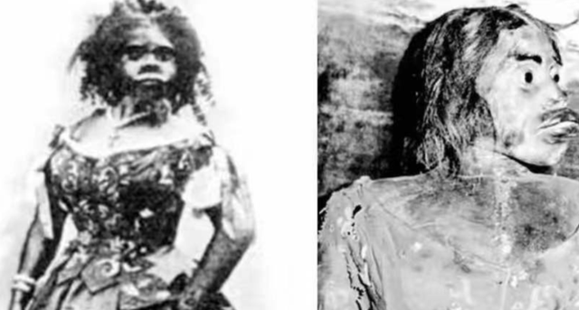 她被称为世上最丑的女人,却被富豪娶走,死后被制成标本供人欣赏