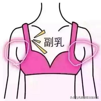 好尴尬：我为什么比别人多长了一个乳房？