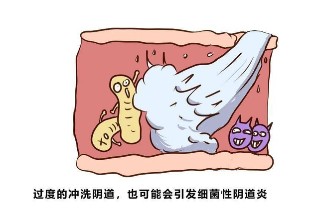 女性的内裤有分泌物，是怎么回事？别害羞，这些异常尽早了解