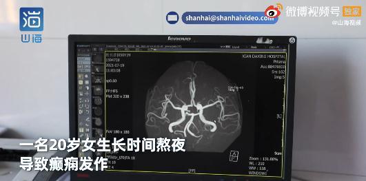 热的冷知识｜女孩突然倒地抽搐！医生：这种病一半是年轻人