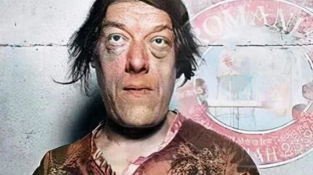 她被称为世上最丑的女人,却被富豪娶走,死后被制成标本供人欣赏