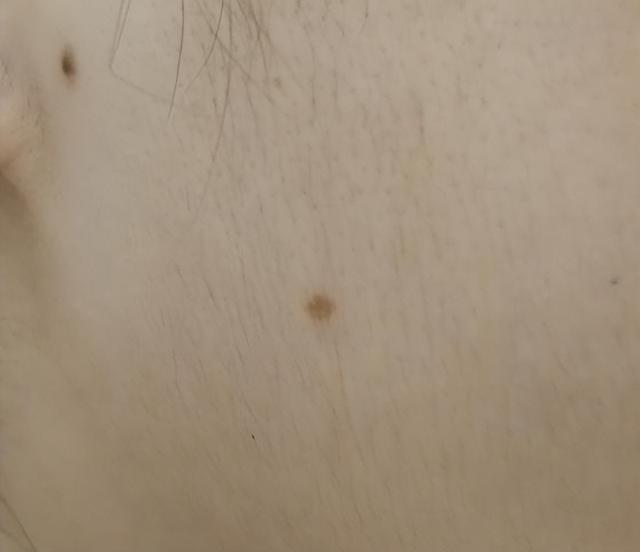 孩子身上这几个“痣”，或是“好福气”的寓意，你家孩子有几个？