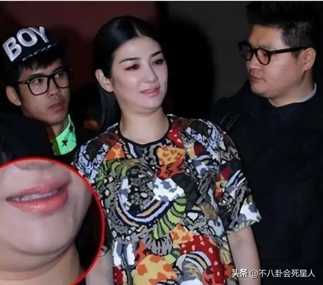 眼袋、胸下垂、胖成球，这些“不体面”的怀孕女星，才是人间真实