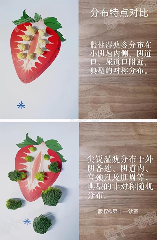 痛得合不拢腿、迈不开步,私处长的这东西到底是啥啊?