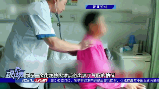 女子拔罐后胸闷气短，竟是“气胸”！这类人群要谨慎