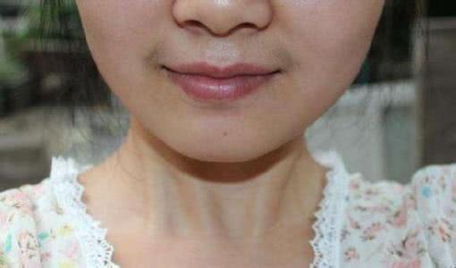 为什么有的女性嘴边会长出“小胡子”？可以经常刮吗？告诉你答案