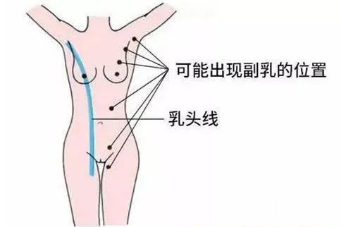 长三个乳头,是进化还是返祖?