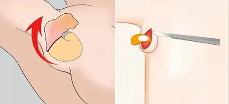 长三个乳头,是进化还是返祖?