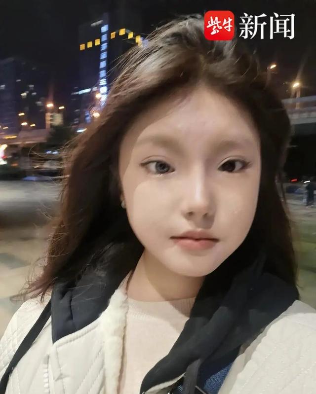 18岁女孩左眼天生蓝瞳，当事人回应