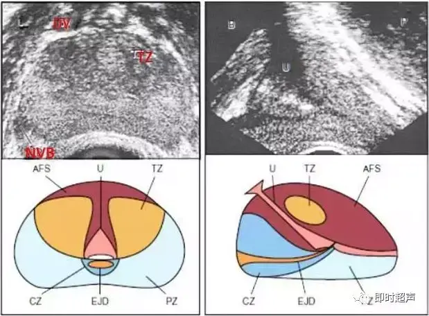 前列腺检查方法、标准切面及测量值汇总