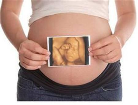 孕妈做四维彩超时，胎儿捂着脸不让看，孕妈早了解原因，少担心