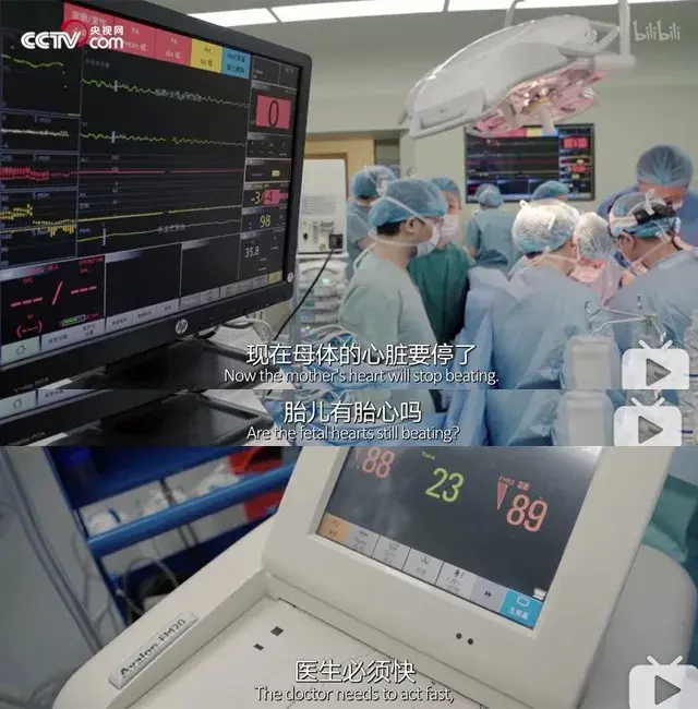 胎梦和未来宝宝有关联?这背后还真有科学道理