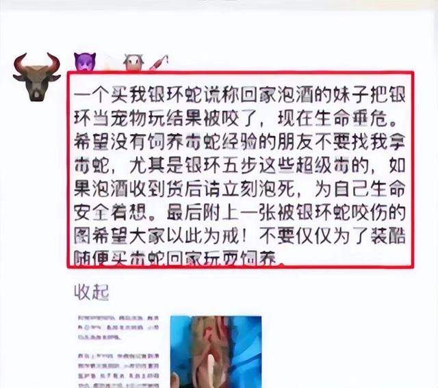 18年陕西女孩养蛇当宠物,不慎被咬伤,抢救时宁死不说是什么蛇