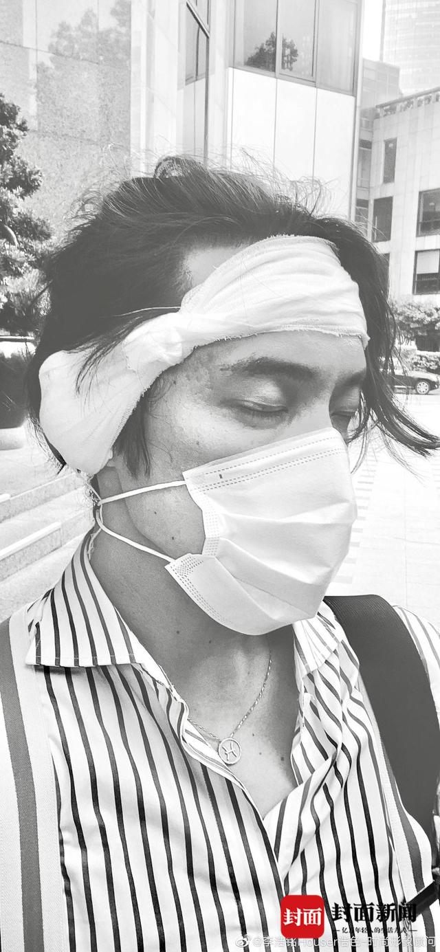 女孩街头被侵害 施救者被咬掉左耳:选择勇敢 不后悔站出来