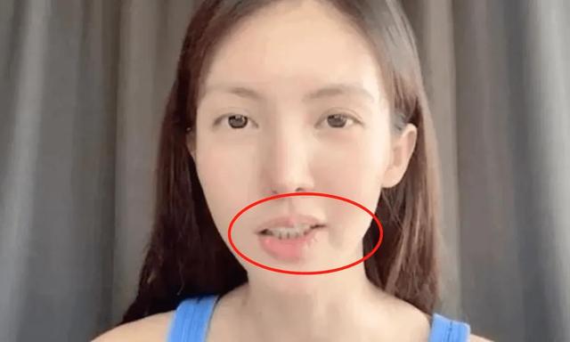 明明貌美如花，却毁在一张嘴上，这7位女星的“丑嘴巴”太拖后腿