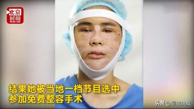 23岁女孩为改变命运整容,整成美女亲妈都不认得